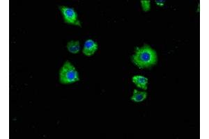 Immunofluorescence staining of Hela cells with ABIN7162449 at 1:100, counter-stained with DAPI. (P2RX7 anticorps  (AA 110-247))