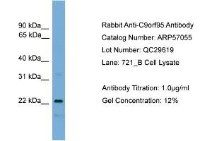 WB Suggested Anti-C9orf95  Antibody Titration: 0. (NMRK1 anticorps  (N-Term))