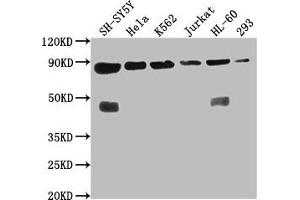 Western Blot Positive WB detected in: SH-SY5Y whole cell lysate, Hela whole cell lysate, K562 whole cell lysate, Jurkat whole cell lysate, HL60 whole cell lysate, 293 whole cell lysate All lanes: YY1AP1 antibody at 1:2000 Secondary Goat polyclonal to rabbit IgG at 1/50000 dilution Predicted band size: 88, 84, 82, 81, 76, 80, 51, 96, 98 kDa Observed band size: 88 kDa (YY1AP1 anticorps  (AA 335-466))