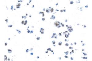 Immunocytochemistry (ICC) image for anti-Bromodomain Containing 3 (BRD3) (AA 676-726) antibody (ABIN7455203) (Recombinant BRD3 anticorps  (AA 676-726))
