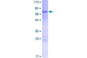Image no. 1 for Acid Phosphatase, Testicular (ACPT) (AA 1-426) protein (GST tag) (ABIN1305695)