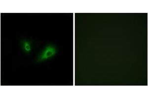 Immunofluorescence analysis of LOVO cells, using OR10D4 Antibody. (OR10D4P anticorps  (AA 161-210))