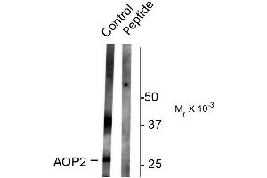 Western blots of rat kidney lysate showing specific immunolabeling of the ~ 29k and 37k glycosylated form of the AQP2 protein phosphorylated at Ser261. (AQP2 anticorps  (pSer261))