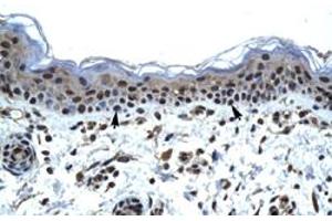 Immunohistochemical staining (Formalin-fixed paraffin-embedded sections) of human skin with IKZF5 polyclonal antibody  at 4-8 ug/mL working concentration. (IKZF5 anticorps  (N-Term))