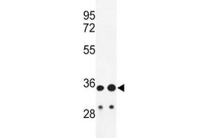 Western blot analysis of IGH antibody and HL-60, A2058 lysate. (IgH anticorps  (AA 290-320))