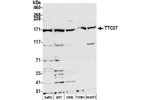 anti-Tetratricopeptide Repeat Domain 37 (TTC37) (AA 1-50) antibody