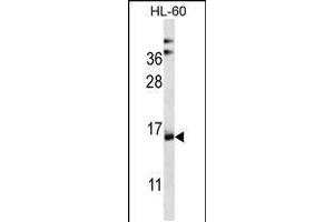 Western blot analysis in HL-60 cell line lysates (35ug/lane). (NDUFAF4 anticorps  (N-Term))