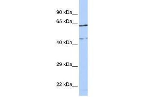 CCDC74A antibody used at 1 ug/ml to detect target protein. (CCDC74A anticorps  (Middle Region))