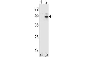 Western Blotting (WB) image for anti-Signal Transducing Adaptor Molecule (SH3 Domain and ITAM Motif) 1 (STAM) antibody (ABIN3001495) (STAM anticorps)