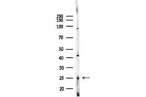 Western blot analysis of lysates from LoVo cells(heat-shock,45 min treatment), using WARS Antibody at 1/1000 dilution.