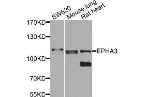 Western blot analysis of extracts of various cells, using EPHA3 antibody. (EPH Receptor A3 anticorps)