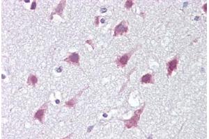 Anti-ZMYM3 antibody IHC staining of human brain, cortex. (ZMYM3 anticorps  (C-Term))