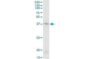 ACTB monoclonal antibody (M03), clone 1E7. (beta Actin anticorps  (AA 1-375))