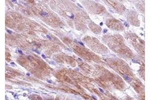 ABIN6267426 at 1/100 staining human Heart muscle tissue sections by IHC-P. (TNNI3 anticorps  (pSer44))