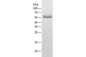 Western Blotting (WB) image for Oxidative-Stress Responsive 1 (OXSR1) (AA 1-527) protein (His-IF2DI Tag) (ABIN7124287)