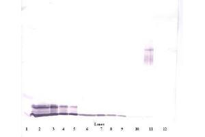 Image no. 4 for anti-Platelet Factor 4 (PF4) antibody (ABIN465152) (PF4 anticorps)