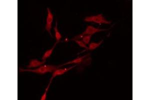 ABIN6274396 staining RAW264. (TTC23 anticorps  (Internal Region))
