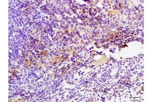 Formalin-fixed and paraffin embedded mouse colon carcinoma labeled with Anti-GPR49/LGR5 Polyclonal Antibody, Unconjugated  at 1:200 followed by conjugation to the secondary antibody and DAB staining. (LGR5 anticorps  (AA 810-907))