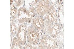 ABIN6277033 at 1/100 staining human kidney tissue sections by IHC-P. (PCK1 anticorps  (C-Term))