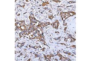 IHC analysis of RAB7/RAB7A using anti-RAB7/RAB7A antibody (ABIN7600597). (RAB7A anticorps  (AA 21-177))
