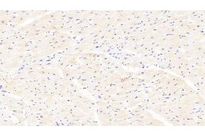 Detection of AMFR in Human Cardiac Muscle Tissue using Polyclonal Antibody to Autocrine Motility Factor Receptor (AMFR) (AMFR anticorps  (AA 456-643))