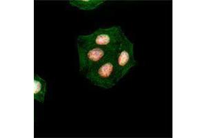Immunofluorescence (IF) image for anti-H2A Histone Family, Member X (H2AFX) (pSer139) antibody (ABIN2666075) (H2AFX anticorps  (pSer139))