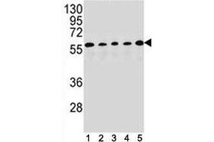 PAX1 antibody western blot analysis in (1) HepG2, (2) MDA-MB453, (3) 293, (4) K562 and (5) MCF-7 lysate. (PAX1 anticorps  (AA 443-471))