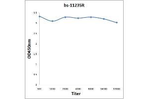 Antigen: 2 µg/100 µL Primary: Antiserum, 1:500, 1:1000, 1:2000, 1:4000, 1:8000, 1:16000, 1:32000; Secondary: HRP conjugated Rabbit Anti-Goat IgG at 1: 5000; TMB staining Read the data in Microplate Reader by 450nm. (GRK4/GRK5/GRK6 (AA 181-280) anticorps)