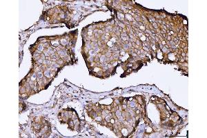 IHC analysis of SNAP23 using anti-SNAP23 antibody (ABIN7599089). (SNAP23 anticorps  (AA 1-211))