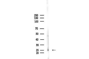 Western blot analysis of lysates from Rat brain, using Phospho-CPI17alpha (Thr38) Antibody at 1/1000 dilution.