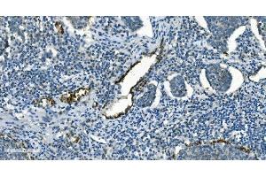 IHC analysis of IDH2 using anti-IDH2 antibody (ABIN7602786). (IDH2 anticorps  (C-Term))