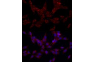 Immunofluorescence analysis of PC-12 cells using SRP72 Rabbit pAb (ABIN6134166, ABIN6148452, ABIN7101299 and ABIN7101300) at dilution of 1:100 (40x lens).