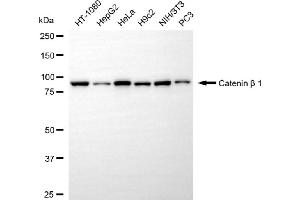 Western blotting analysis using catenin beta 1 antibody (ABIN7797927).