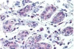 Anti-ABCB5 antibody IHC of human breast.