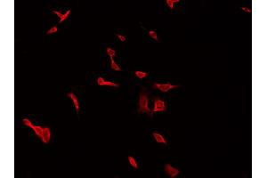 ABIN6266623 staining HepG2 by IF/ICC.