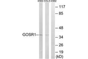 Western blot analysis of extracts from COLO/K562 cells, using GOSR1 Antibody. (GS28 anticorps  (AA 11-60))