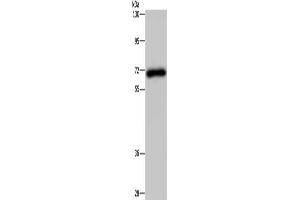 Gel: 8 % SDS-PAGE, Lysate: 40 μg, Lane: Human kidney tissue, Primary antibody: ABIN7191664(NMT1 Antibody) at dilution 1/200, Secondary antibody: Goat anti rabbit IgG at 1/8000 dilution, Exposure time: 3 minutes (NMT1 anticorps)