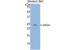 Western Blotting (WB) image for anti-Cathelicidin Antimicrobial Peptide (CAMP) (AA 31-170) antibody (Biotin) (ABIN1175686) (Cathelicidin anticorps  (AA 31-170) (Biotin))