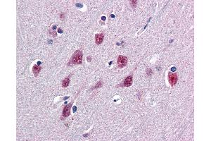 Anti-SMUG1 antibody IHC of human brain, cortex. (SMUG1 anticorps  (AA 2-14))
