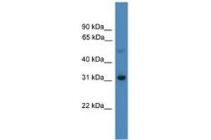 Image no. 1 for anti-Ladybird Homeobox 1 (Lbx1) (AA 21-70) antibody (ABIN6745343) (Lbx1 anticorps  (AA 21-70))