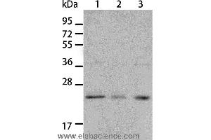 Western blot analysis of A431 and A172 cell, human liver cancer tissue, using BNIP1 Polyclonal Antibody at dilution of 1:550 (BNIP1 anticorps)