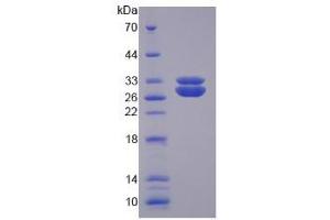 SDS-PAGE analysis of Human SOD3 Protein. (SOD3 Protéine)