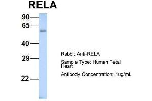 Host: Rabbit  Target Name: RELA  Sample Tissue: Human Fetal Heart  Antibody Dilution: 1. (NF-kB p65 anticorps  (Middle Region))