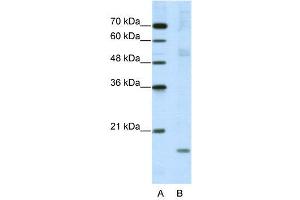 WB Suggested Anti-NIP7  Antibody Titration: 5. (NIP7 anticorps  (C-Term))