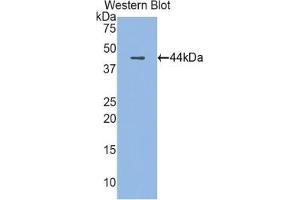 Detection of Recombinant CAMP, Rat using Polyclonal Antibody to Cathelicidin Antimicrobial Peptide (CAMP) (Cathelicidin anticorps  (AA 30-175))