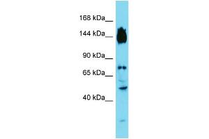 Host: Rabbit Target Name: SYDE2 Sample Type: Fetal Liver lysates Antibody Dilution: 1. (SYDE2 anticorps  (C-Term))