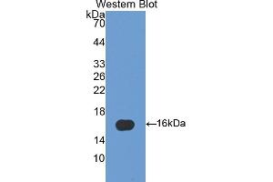 Detection of Recombinant FABP5, Human using Polyclonal Antibody to Fatty Acid Binding Protein 5 (FABP5) (FABP5 anticorps  (AA 2-135))