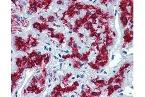 VEZF1 antibody was used for immunohistochemistry at a concentration of 4-8 ug/ml.