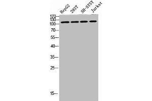 Western blot analysis of SW480 MCF7 lysate, antibody was diluted at 500.