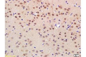 Formalin-fixed and paraffin embedded rat brain labeled with Rabbit Anti NRF-1 Polyclonal Antibody, Unconjugated (ABIN675219) at 1:200 followed by conjugation to the secondary antibody and DAB staining (NRF1 anticorps  (AA 51-180))